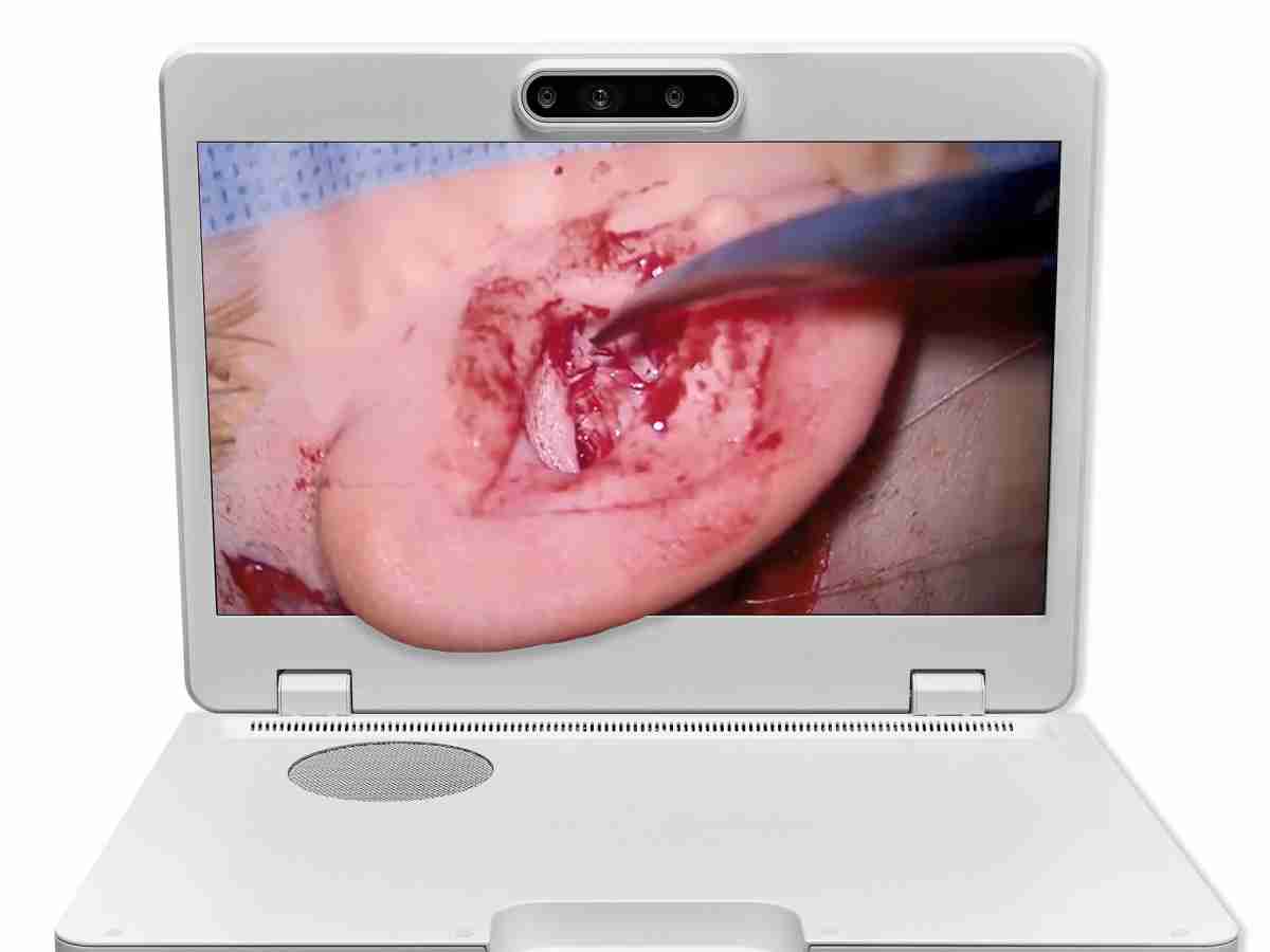 达擎之＂Heads-up 3D显微手术显示系统＂，，，，整合4K裸眼3D显示及眼球追踪系统，，，具备快速追踪人眼移动位置功能，，减轻医师长时间维持固定姿势的负担，，，让医师能有更宽广清晰的3D立体视野及更舒适的姿势来执行手术。。。。